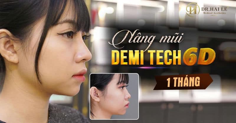 Hành trình lột xác hóa girl xinh của Như Quỳnh nhờ Nâng mũi thẩm mỹ