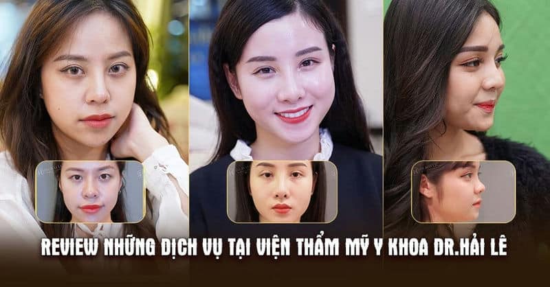 Review những dịch vụ tại Viện thẩm mỹ y khoa Dr.Hải Lê
