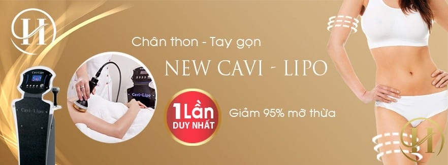 Hút mỡ đùi với công nghệ cao