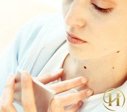 Nốt ruồi ở cổ họng thường không đem laij may mắn cho chủ nhân