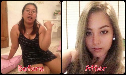 "Duyên yêu" đến với cô gái béo Thái Lan sau khi thẩm mỹ