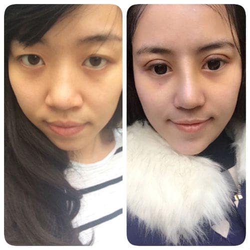 Sốc với bà mẹ 9x quyết định thẩm mỹ để "giữ chồng"