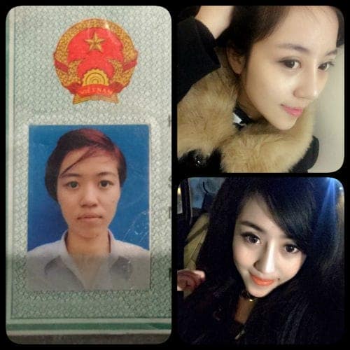 Sốc với bà mẹ 9x quyết định thẩm mỹ để "giữ chồng"