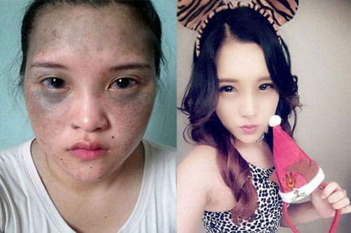 "Soi" diện mạo mới của 10 thiếu nữ Việt sau khi "dao kéo""Soi" diện mạo mới của 10 thiếu nữ Việt sau khi "dao kéo"