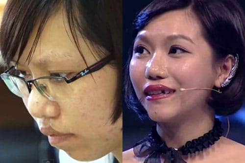 "Soi" diện mạo mới của 10 thiếu nữ Việt sau khi "dao kéo"