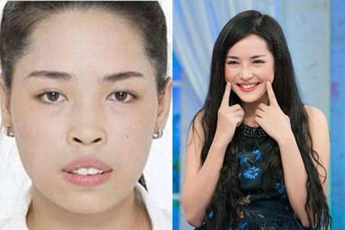 "Soi" diện mạo mới của 10 thiếu nữ Việt sau khi "dao kéo"