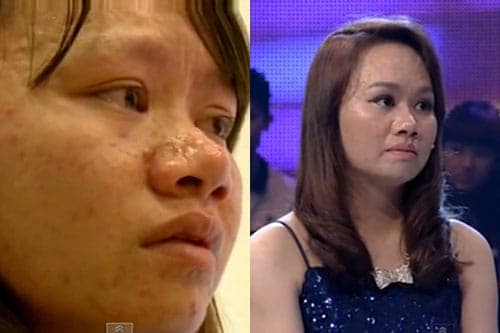 "Soi" diện mạo mới c"Soi" diện mạo mới của 10 thiếu nữ Việt sau khi "dao kéo"ủa 10 thiếu nữ Việt sau khi "dao kéo"