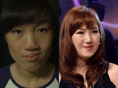 "Soi" diện mạo mới của 10 thiếu nữ Việt sau khi "dao kéo"