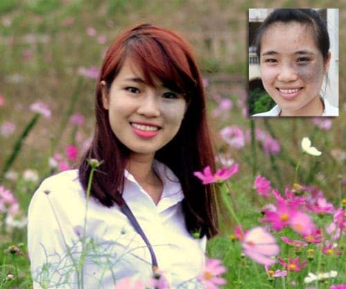 "Soi" diện mạo mới của 10 thiếu nữ Việt sau khi "dao kéo"