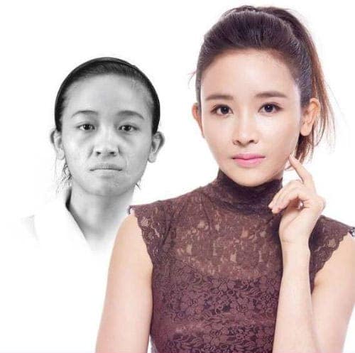 "Soi" diện mạo mới của 10 thiếu nữ Việt sau khi "dao kéo"