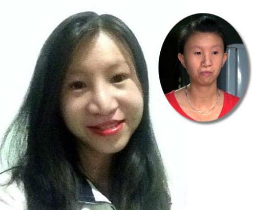 "Soi" diện mạo mới của 10 thiếu nữ Việt sau khi "dao kéo"