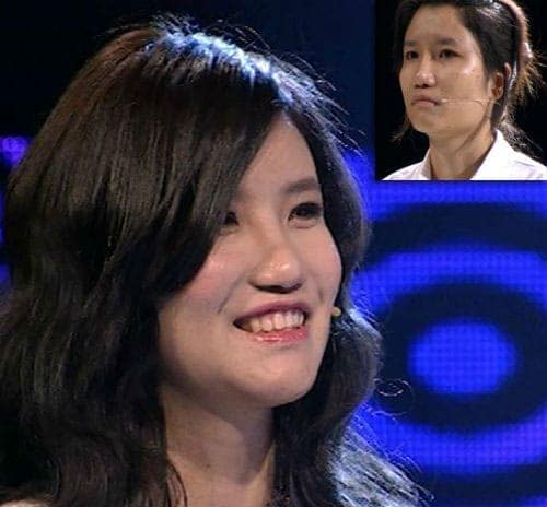 "Soi" diện mạo mới của 10 thiếu nữ Việt sau khi "dao kéo"
