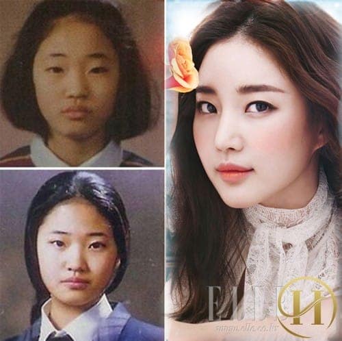 Hoa hậu Hàn Quốc 2000, Kim Sa Rang trước đây có đôi mắt 1 mí đặc trưng của người Hàn nhưng hiện tại khán giả có thể nhìn thấy đôi mắt của hoa hậu đã được "cải tiến" rất nhiều.