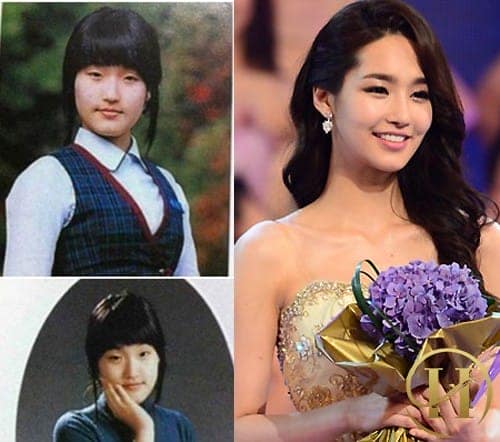 "Hoa hậu dao ké" Kim Yu Mi nổi tiếng của Hàn Quốc cũng đã cắt mí để có được nhan sắc đẹp không tì vết như hiện tại.