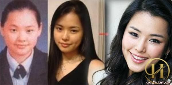 Được mệnh danh là "Hoa hậu đẹp nhất trong cách Hoa hậu Hàn Quốc" nhưng người đẹp này cũng đã phải nhờ tới sự can thiệp của dao kéo. Khi tấm ảnh thẻ thời còn đi học của cô bị tiết lộ, bạn có thểnhận thấy đôi mắt một mí của Honey Lee đã được "biến đổi" một cách điệu nghệ. 