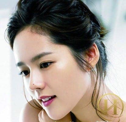 Có khá nhiều ngươi có vị trí nốt ruồi trên mũi