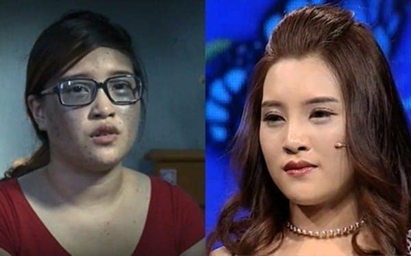Những diện mạo mới khiến bạn "đứng hình" nhờ phẫu thuật thẩm mỹ