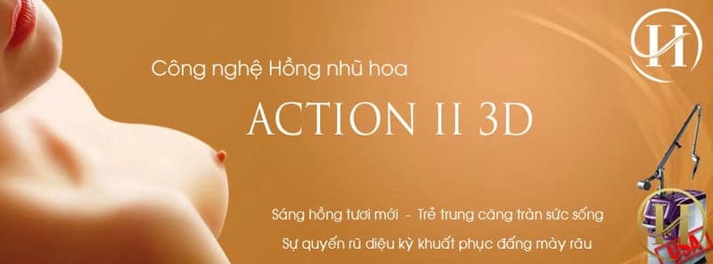 Làm hồng nhũ hoa an toàn, hiệu quả bằng công nghệ Laser Action II 3D