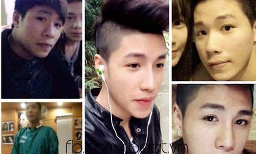 Chàng trai Hải Phòng quyết định phẫu thuật thẩm mỹ toàn bộ khuôn mặt