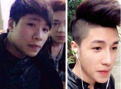 Nhờ sự can thiệp của "dao kéo" ND đã hoàn toàn lột xác
