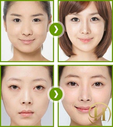 Chiếc mũi cao, thanh tú giúp bạn gái tự tin, quyến rũ hơn