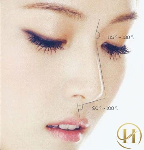 Có rất nhiều người lo lắng về các biến chứng có thể gặp phải sau khi nâng mũi