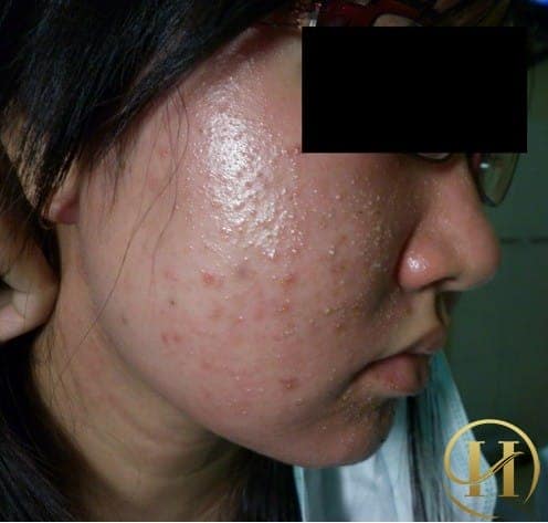 Khi sử dụng các sản phẩm này bạn phải đối diện với rất nhiều nguy cơ tiềm ẩn