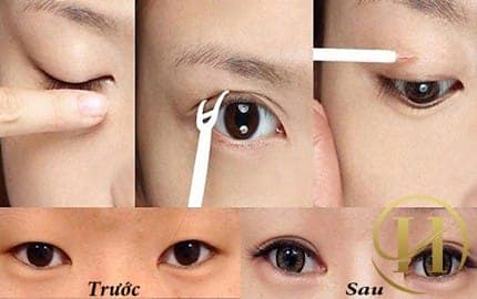 Nhiều bạn gái đã lựa chọn dụng cụ này để "biến hóa" đôi mắt 1 mí trở nên to và cuốn hút hơn
