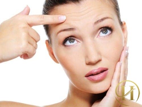 Nếp nhăn trên trán nói lên điều gì
