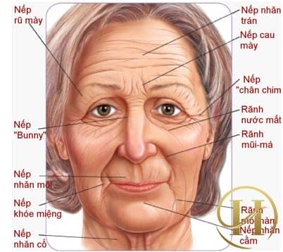 Nhận biết bệnh thông qua vị trí của 9 nếp nhăn trên mặt