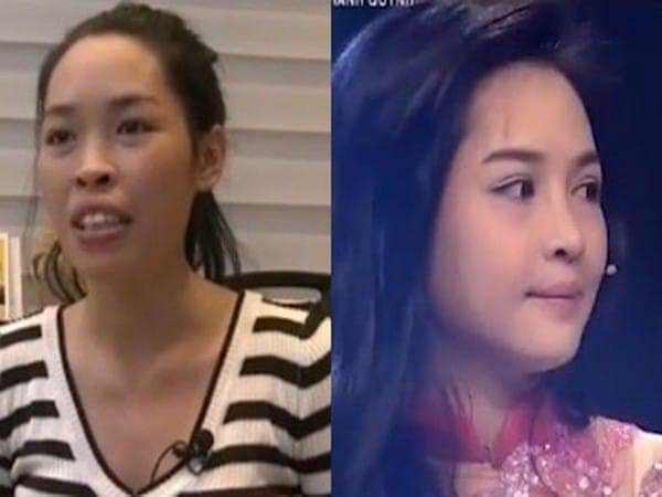 Những diện mạo mới khiến bạn "đứng hình" nhờ phẫu thuật thẩm mỹ