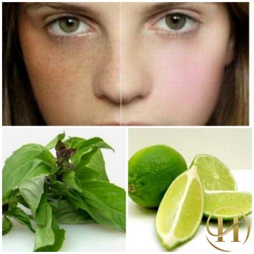 Trị nám da đơn giản bằng rau húng quế và chanh