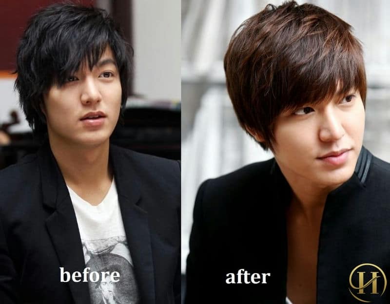 Lộ mặt những mỹ nam từng phẫu thuật thẩm mỹ