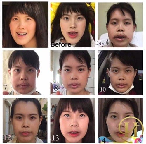 Qúa trình thay đổi của cô gái trẻ