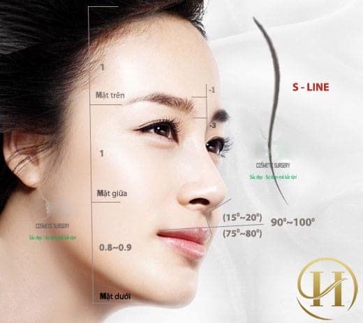 Phẫu thuật nâng mũi bọc sụn Hàn Quốc mang lại kết quả lâu dài 