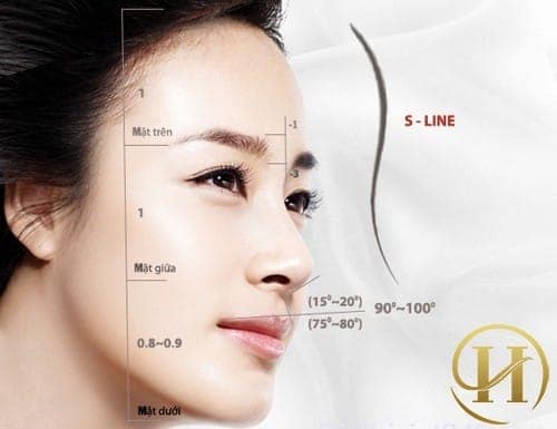 Nâng mũi S-line 4D có được bảo hành không?