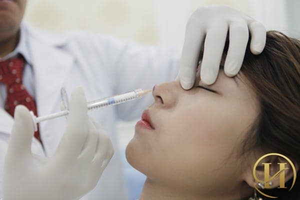 Chất làm đầy filler là giải pháp nâng mũi được rất nhiều khách hàng lựa chọn