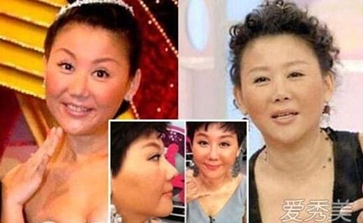 Diện mạo mới của nghệ sĩ u50 sau khi thực hiện "đại tu" nhan sắc