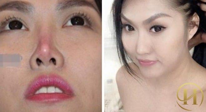 Sự thay đổi của bất ngờ của Phi Thanh Vân