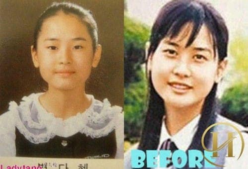 Lee Da Hae trở nên vô cùng xinh đẹp sau khi phẫu thuật thẩm mỹ