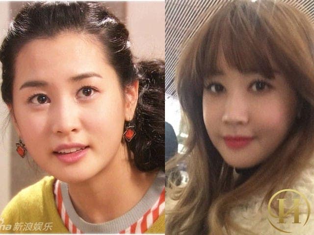 Trước đây cô nàng có chiếc cằm vuông, mũi thấp và mí mắt không rõ ràng