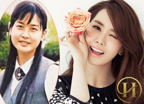  Có thể nhận thất Hoa hậu Chunhyang 2001, Lee Dae Hee đã chỉnh sửa hầu như toàn bộ dung nhan, trong đó bao gồm cả phẫu thuật cắt mí. Đây là phương pháp được rất nhiều phụ nữ Hàn Quốc lựa chọn để cải thiện nhan sắc của mình.