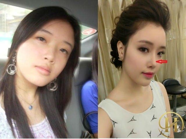 Ở góc ảnh này bạn có thể dễ dàng nhìn thấy sự khác biệt trên chiếc mũi