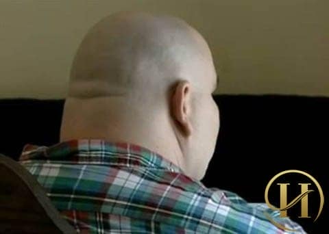 Tòa án đã quyết định không cho ông bố này nuôi con vì quá béo
