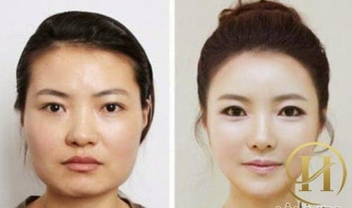 Những cô nàng "vịt hóa thiên nga" nhờ thẩm mỹ