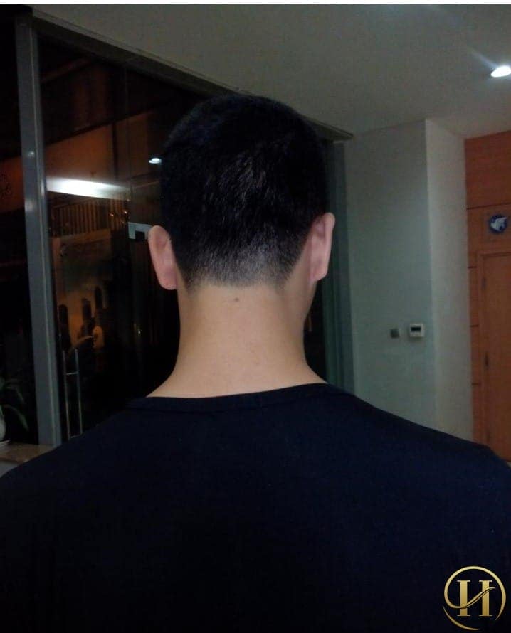 Xem bói ý nghĩa nốt ruồi ở cổ - Những người này thường rất thẳng thắn và chân thành