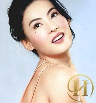 Có khá nhiều chị em lo lắng khi có nốt ruồi dưới mắt