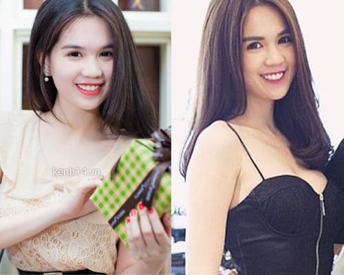 Lộ bằng chứng Ngọc Trinh đã "dao kéo" mắt, mũi và cằm
