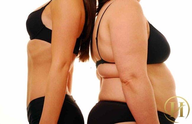 Sự khác biệt hoàn hảo sau khi sử dụng hút mớ bụng bằng New Cavi-lipo