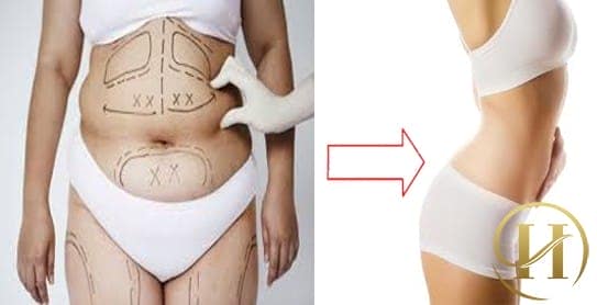 Sự thay đổi bất ngờ từ vòng hai của bạn